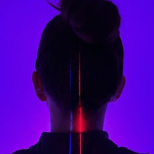 Erchonia Violet and Red laser with FDA clearance for pain at ICE clinics