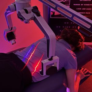 Erchonia Fx405 laser used on lower back pain at ICE clinics