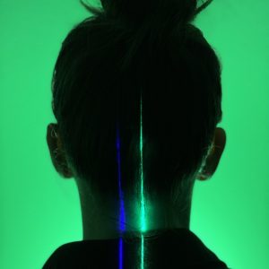 Erchonia's most energetic laser with FDA clearance used at ICE clinics